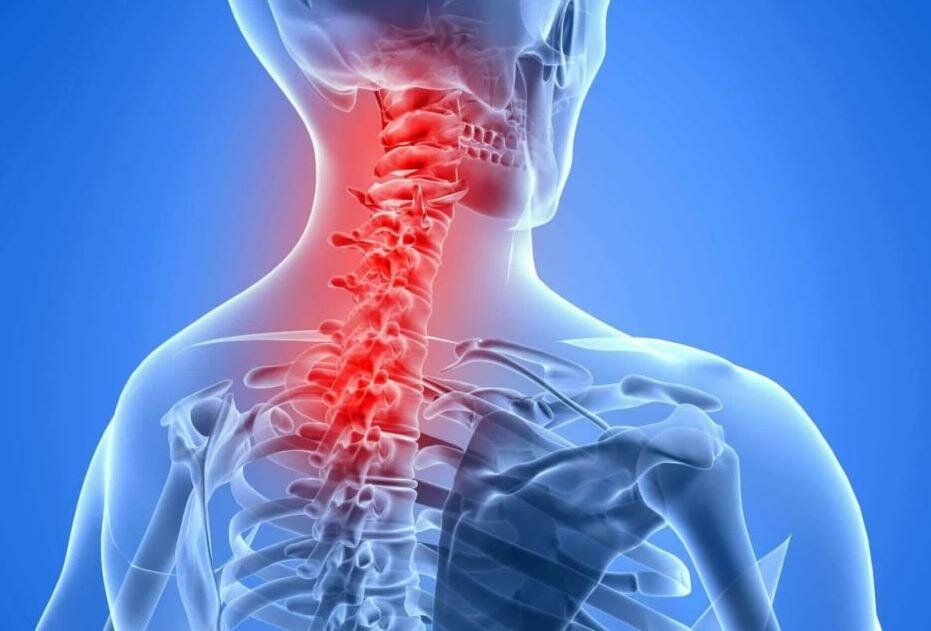 Шейный остеохондроз – проявление и способы борьбы с ним