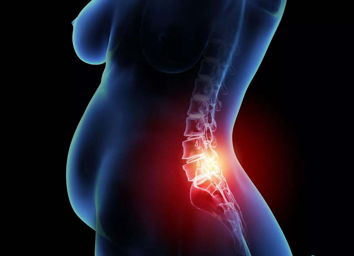 Боли в спине при беременности