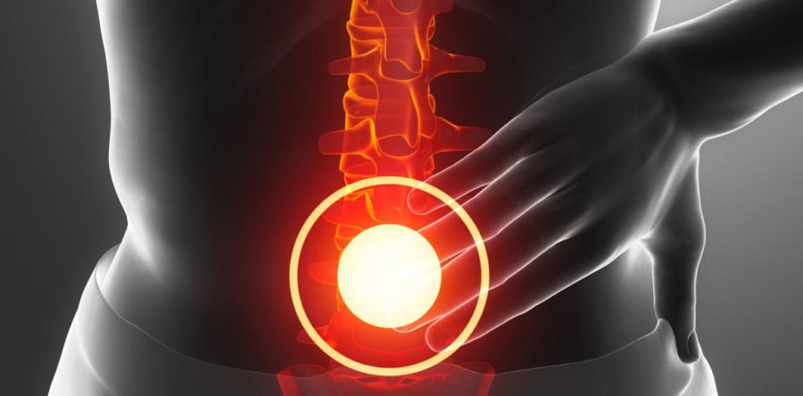 Поясничный радикулит - симптомы, лечение