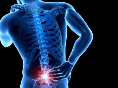 Крестцовый радикулит спины и поясницы - разновидность остеохондроза